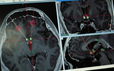 Nouvelle étude sur la santé cognitive des aînés